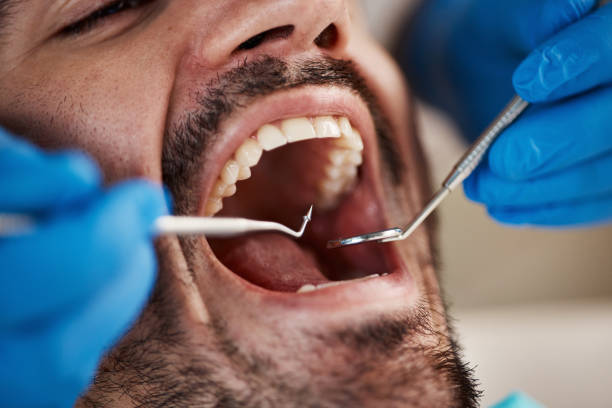 Best Weekend Emergency Dental Services in Wood River, IL